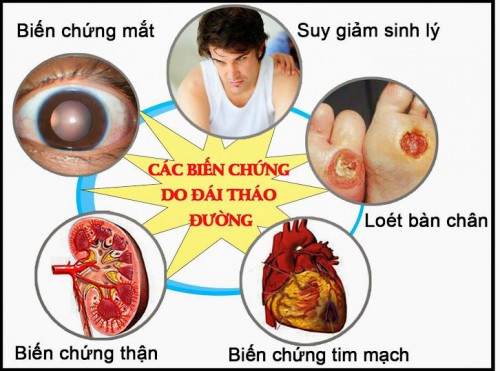 Nguyên nhân và cách đẩy lùi tiểu đường bằng Đông Y